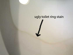 Remove Toilet Stains